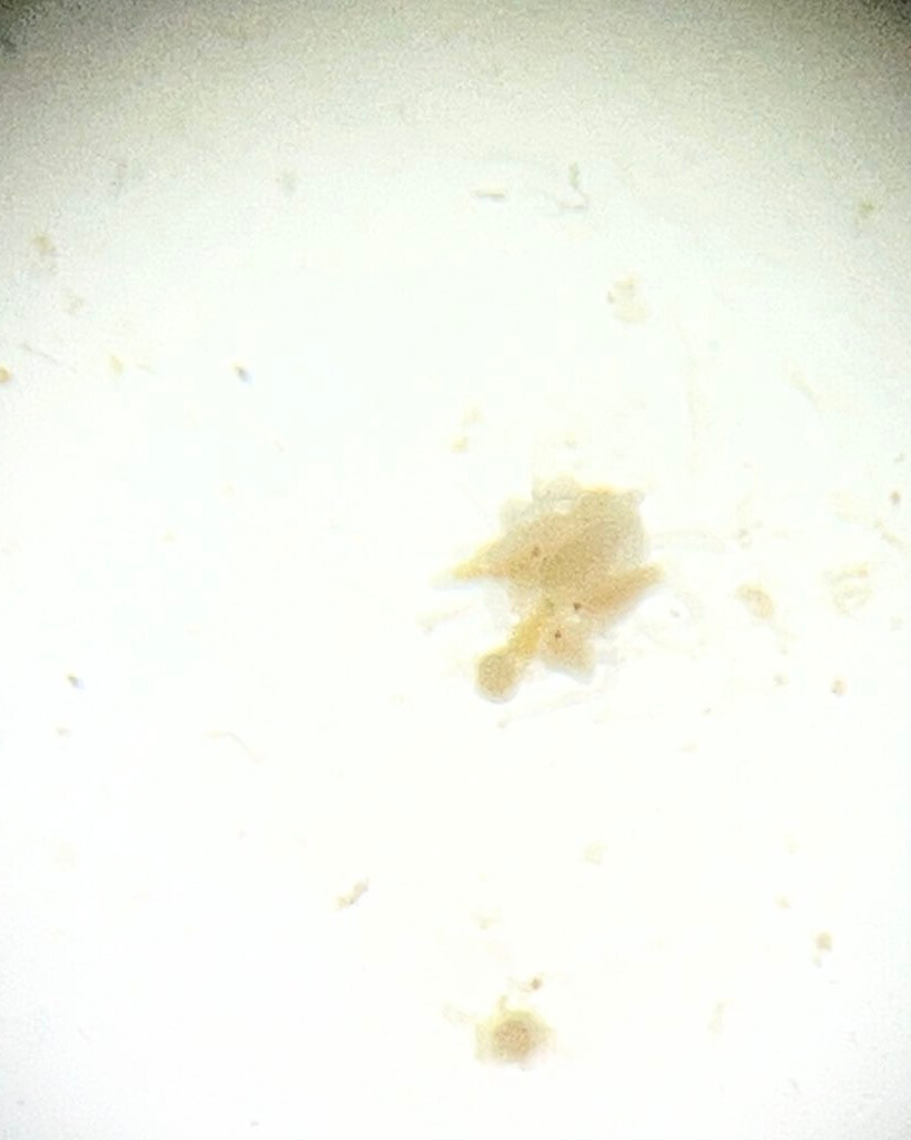 餌のブラインシュリンプを捉えるポリプ